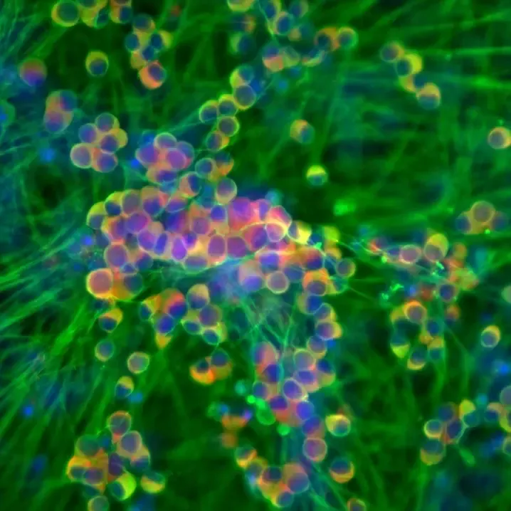 Pain in the neuron